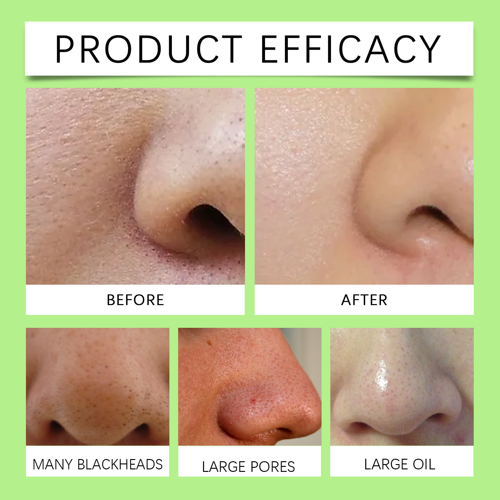 Бамбуковые угольные полоски дл – обзор и цена Cleanser Face